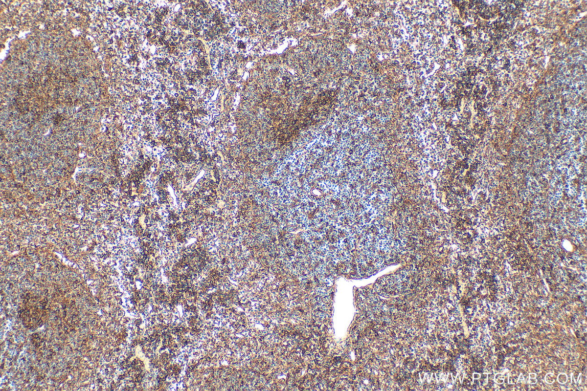 IHC staining of mouse spleen using 86038-1-RR