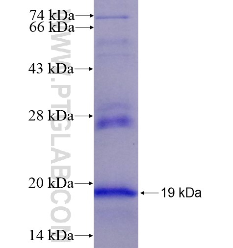 CCR5 fusion protein Ag14631 SDS-PAGE CCR5 fusion protein Ag14631 SDS-PAGE