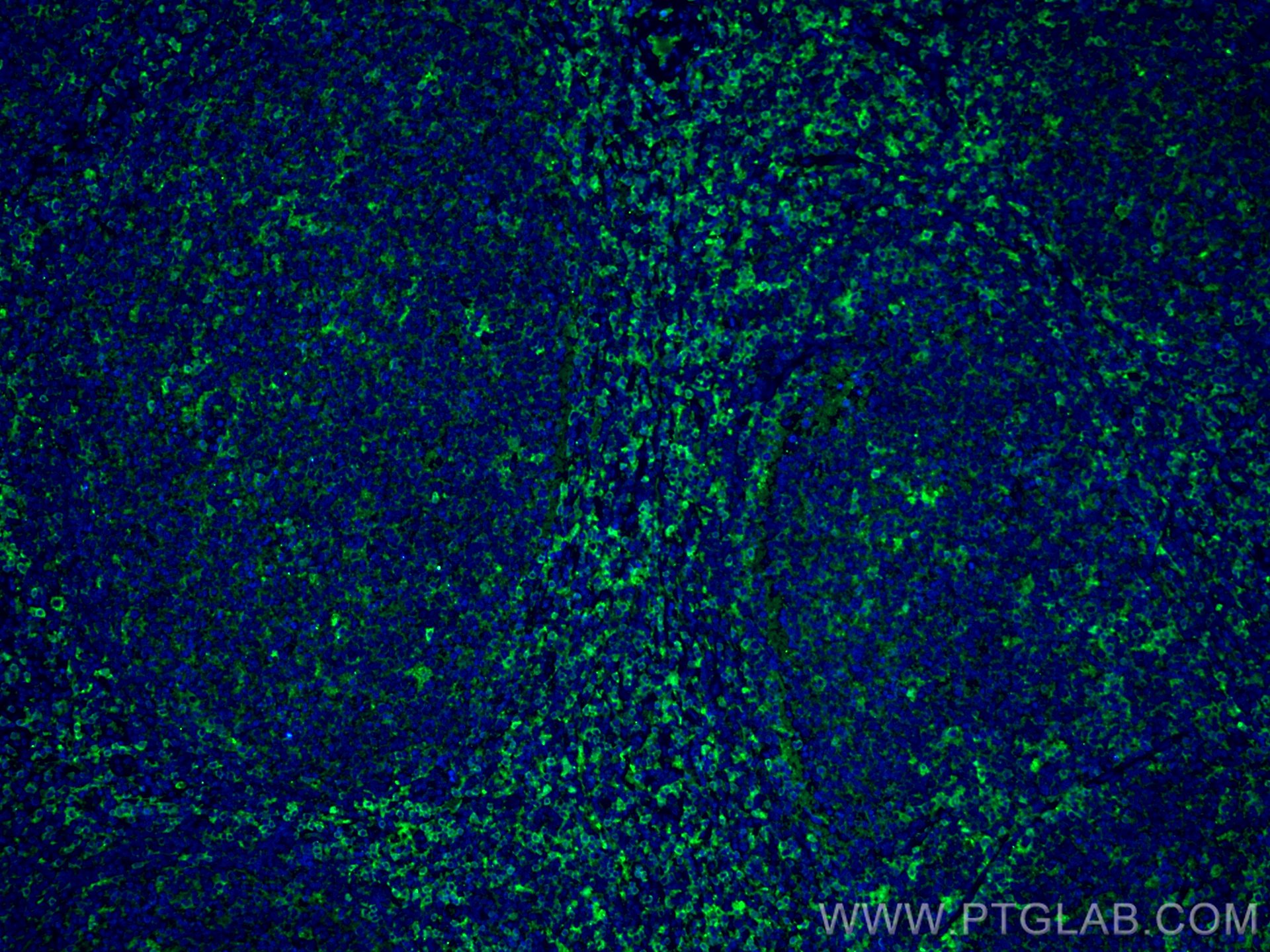 IF Staining of human tonsillitis using 66801-1-Ig