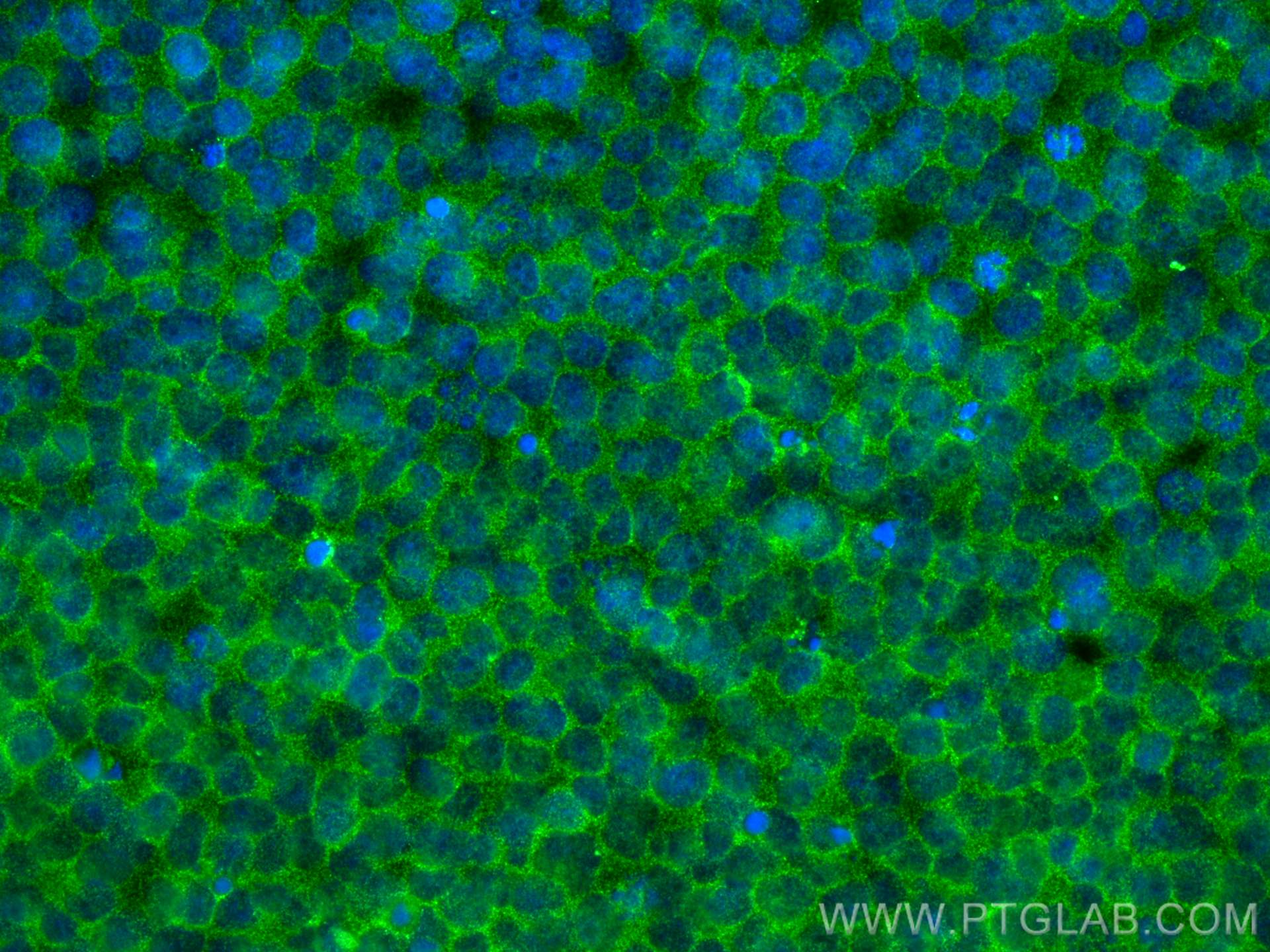 IF Staining of Jurkat using 66801-1-Ig (same clone as 66801-1-PBS)