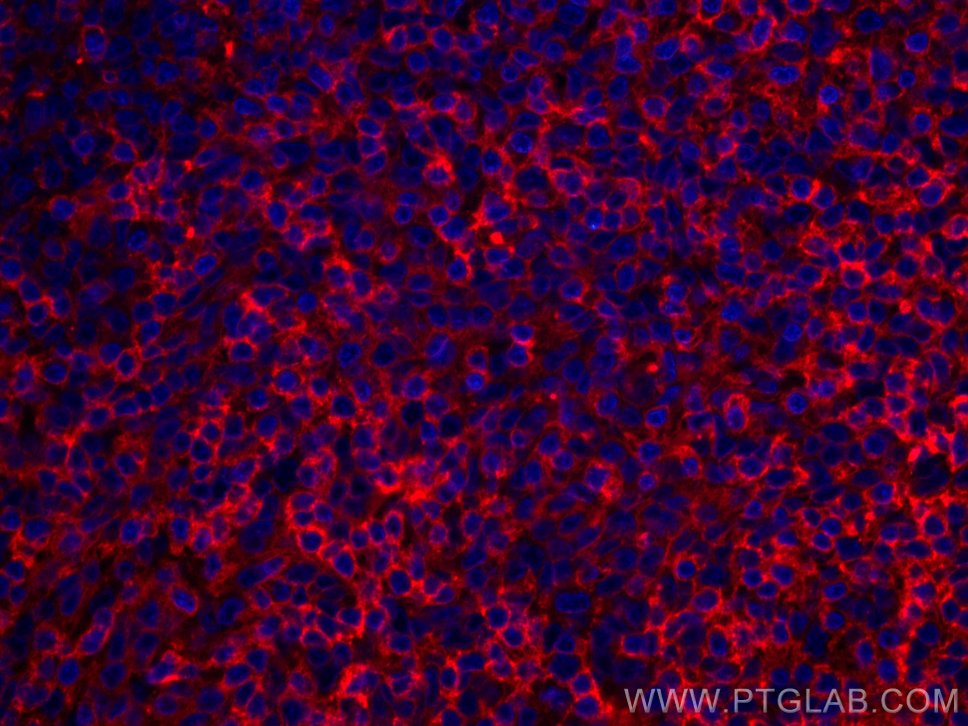 IF Staining of human tonsillitis using CL594-66801