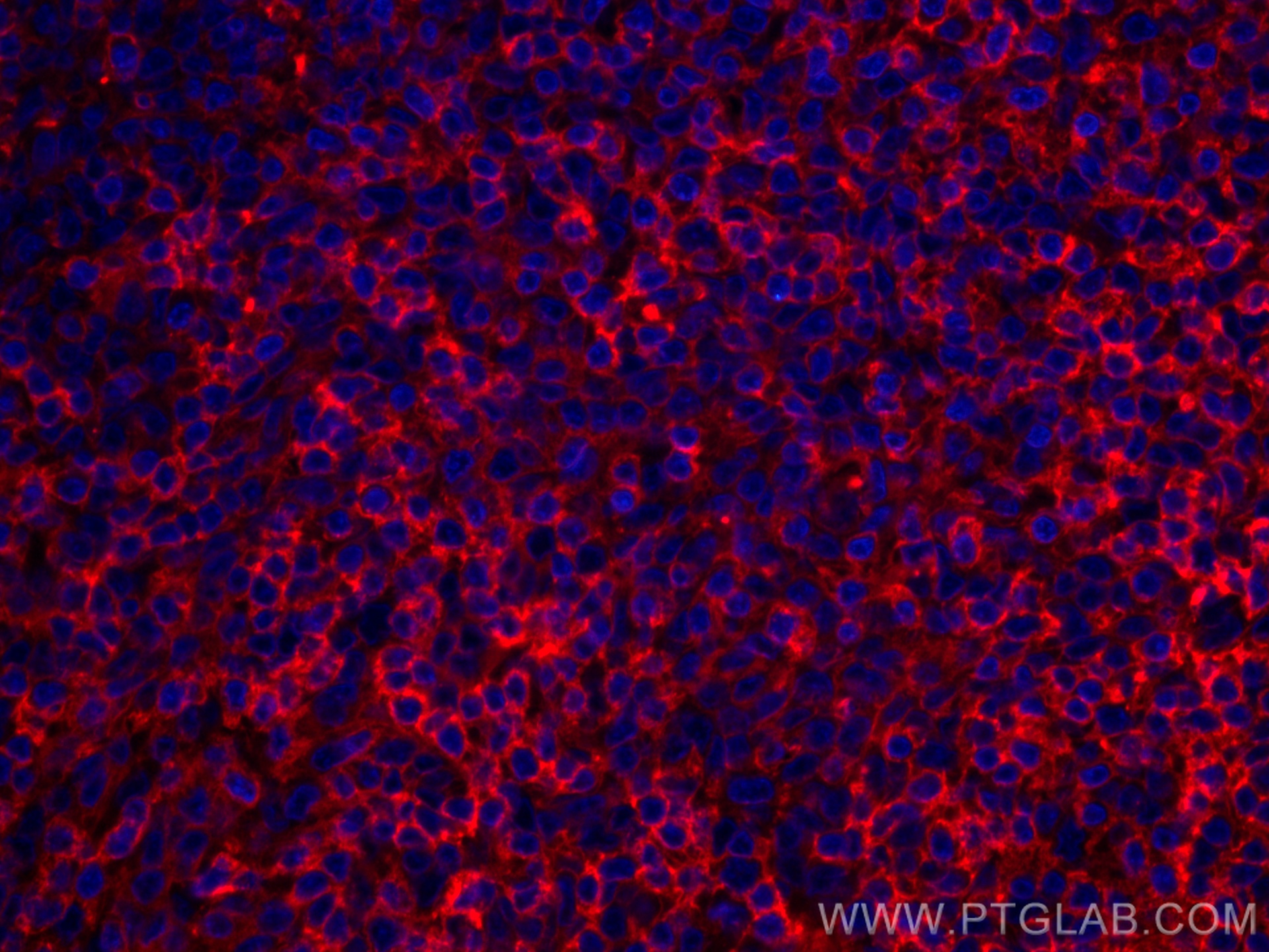 IF Staining of human tonsillitis using CL594-66801