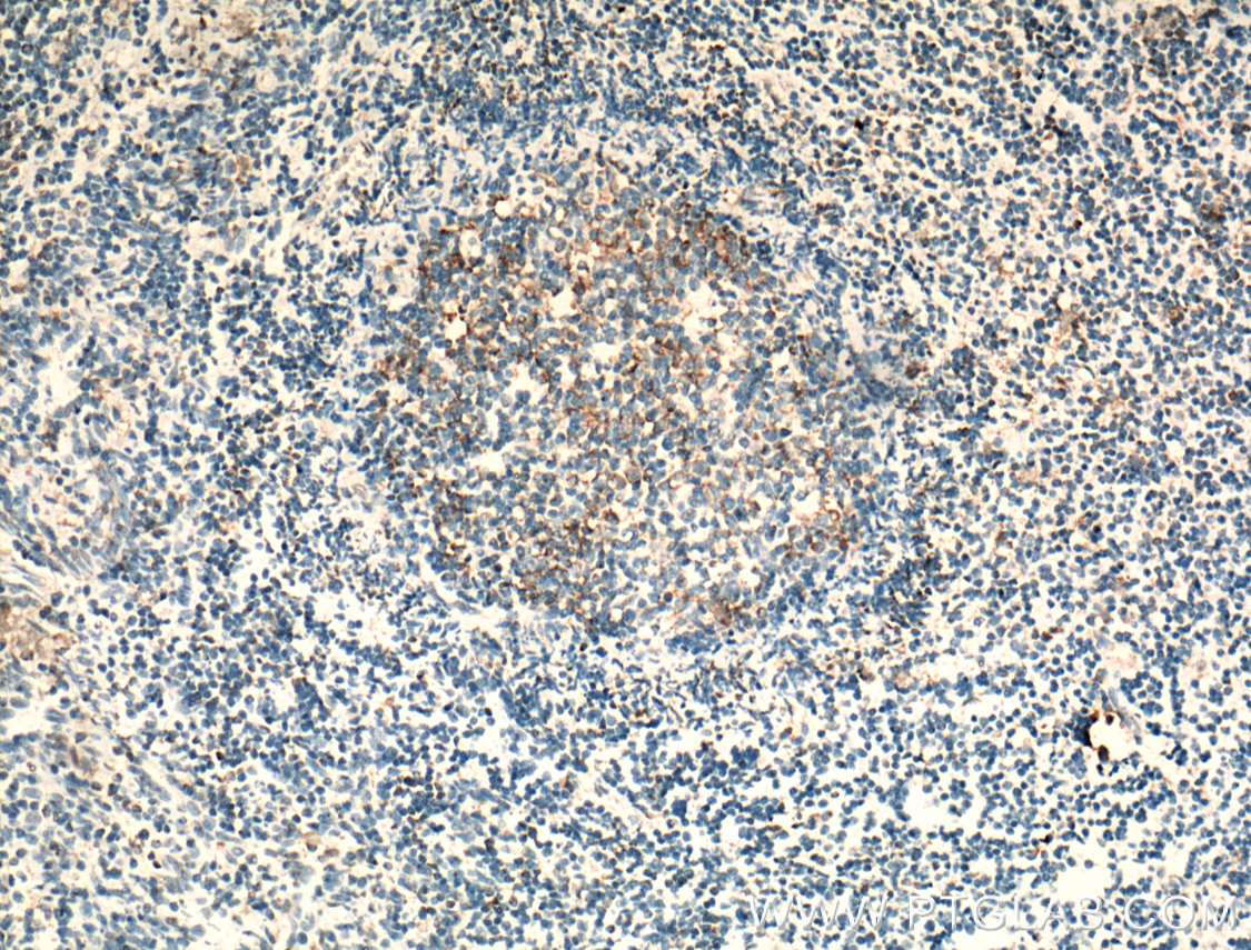 IHC staining of human tonsillitis using 25898-1-AP