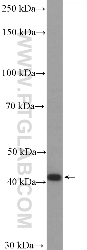 WB analysis of MCF-7 using 25898-1-AP