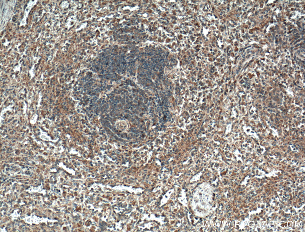 IHC staining of human spleen using 66611-1-Ig