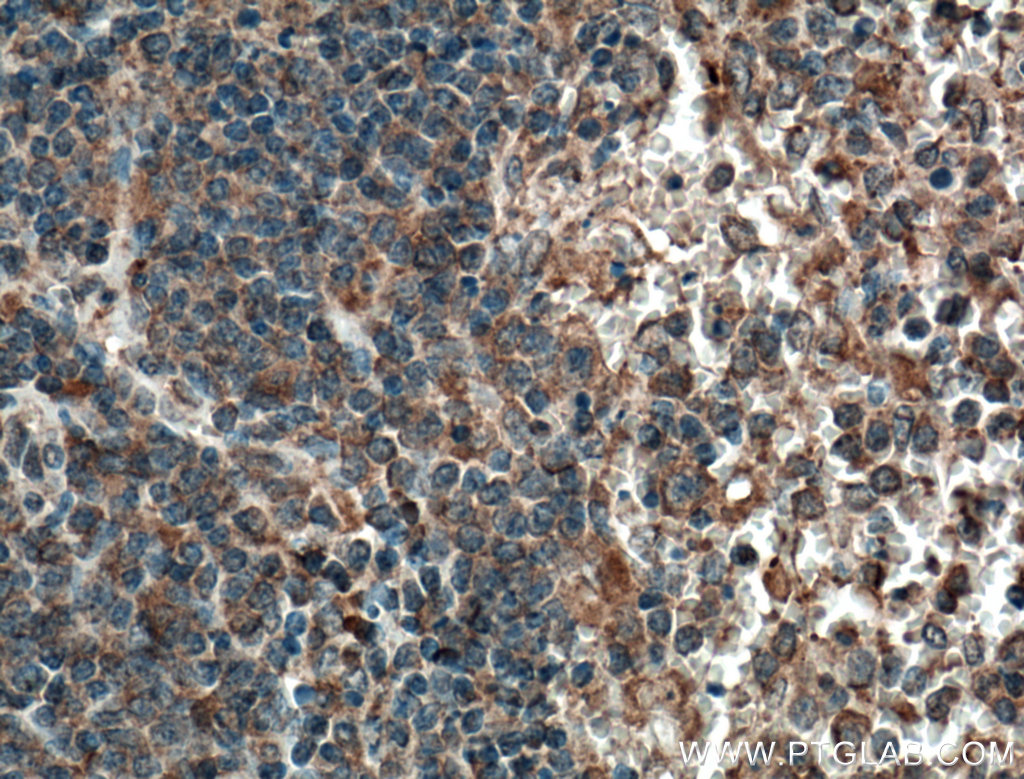 IHC staining of human spleen using 66611-1-Ig (same clone as 66611-1-PBS)