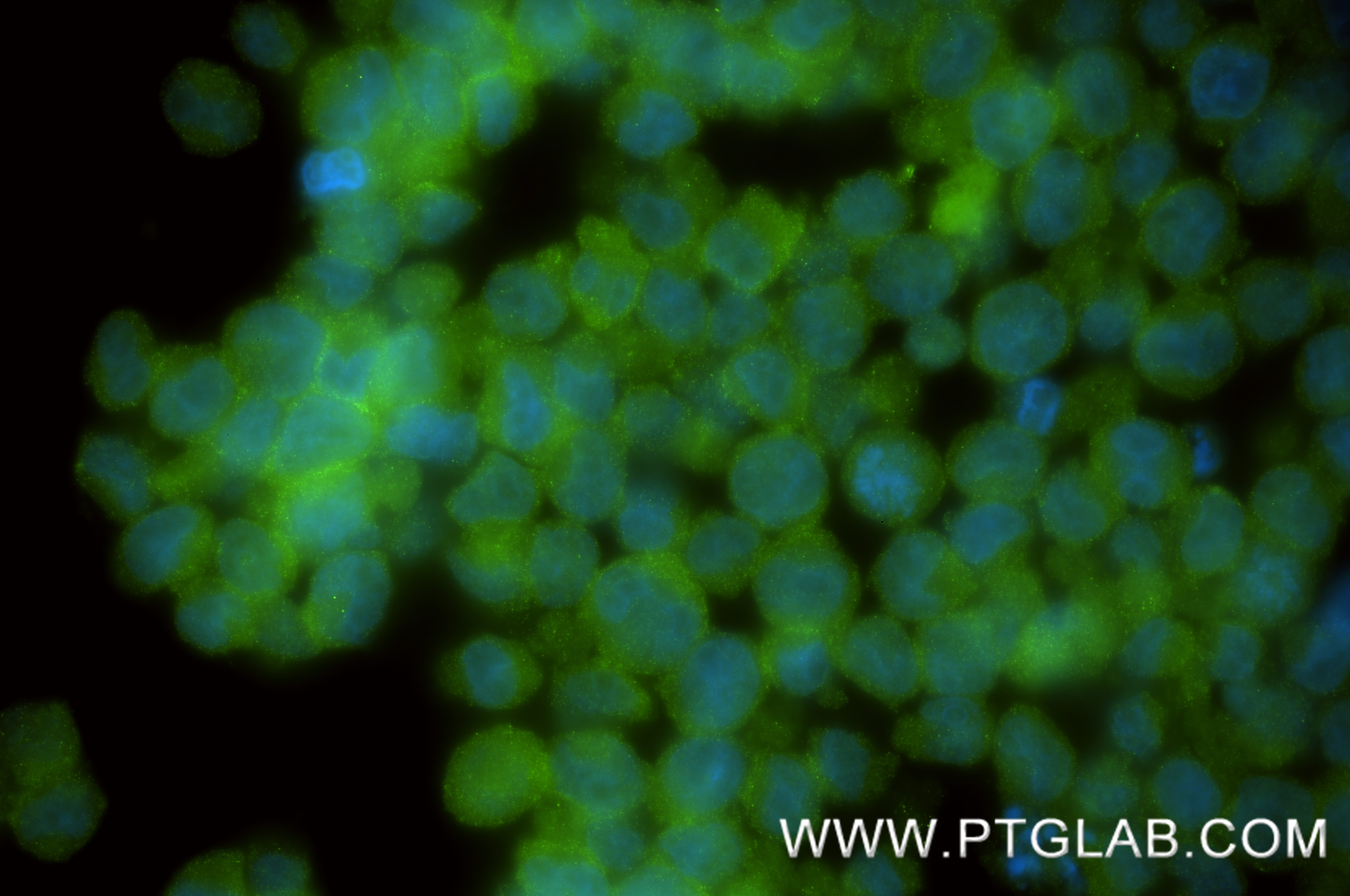 IF Staining of TF-1 using 87505-1-RR IF Staining of TF-1 using 87505-1-RR