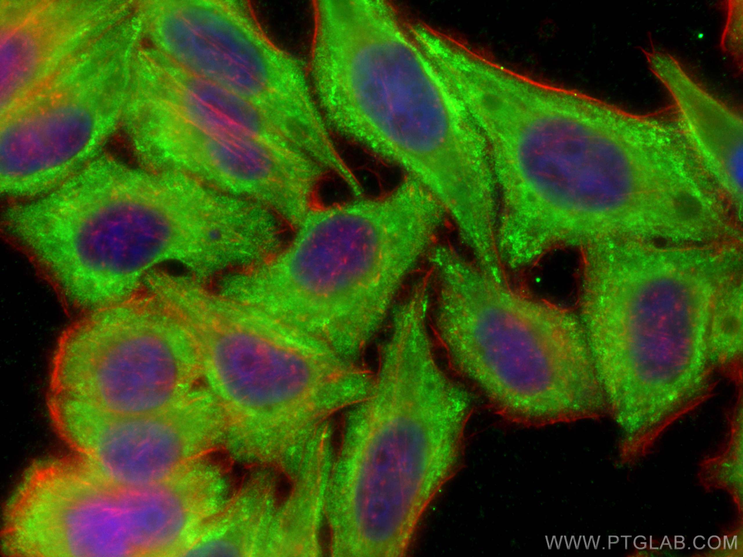 IF Staining of HepG2 using 22802-1-AP