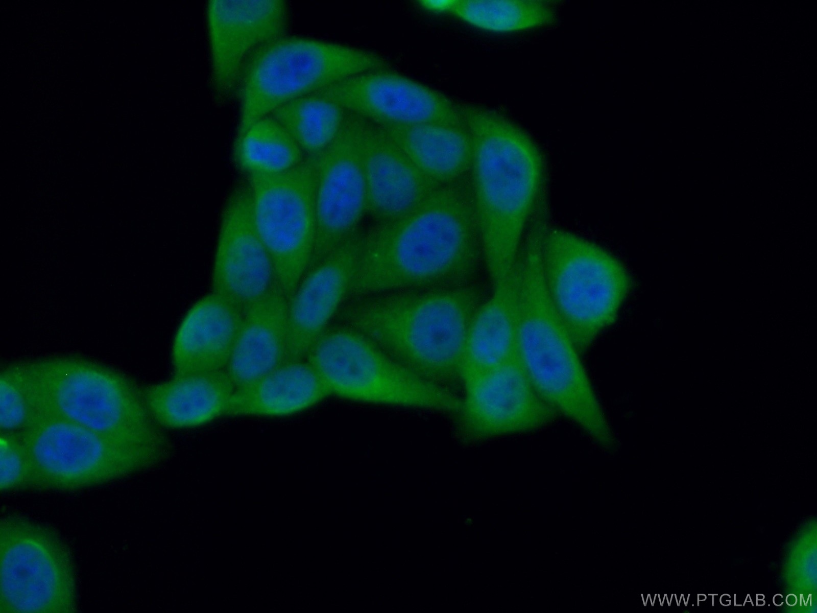 IF Staining of HepG2 using 22802-1-AP