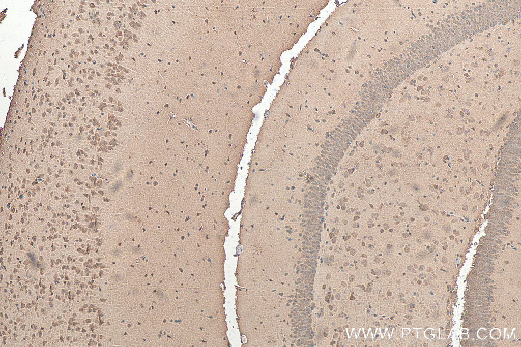 IHC staining of mouse brain using 22802-1-AP