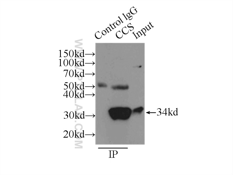 IP experiment of HepG2 using 22802-1-AP