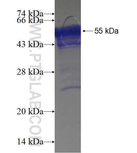 CCS fusion protein Ag18850 SDS-PAGE