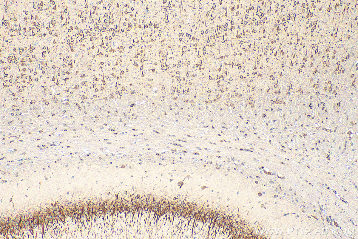 Immunohistochemical analysis of paraffin-embedded rat brain tissue slide using 28644-1-AP (CCSAP antibody) at dilution of 1:200 (under 10x lens). Heat mediated antigen retrieval with Tris-EDTA buffer (pH 9.0). IHC staining of rat brain using 28644-1-AP