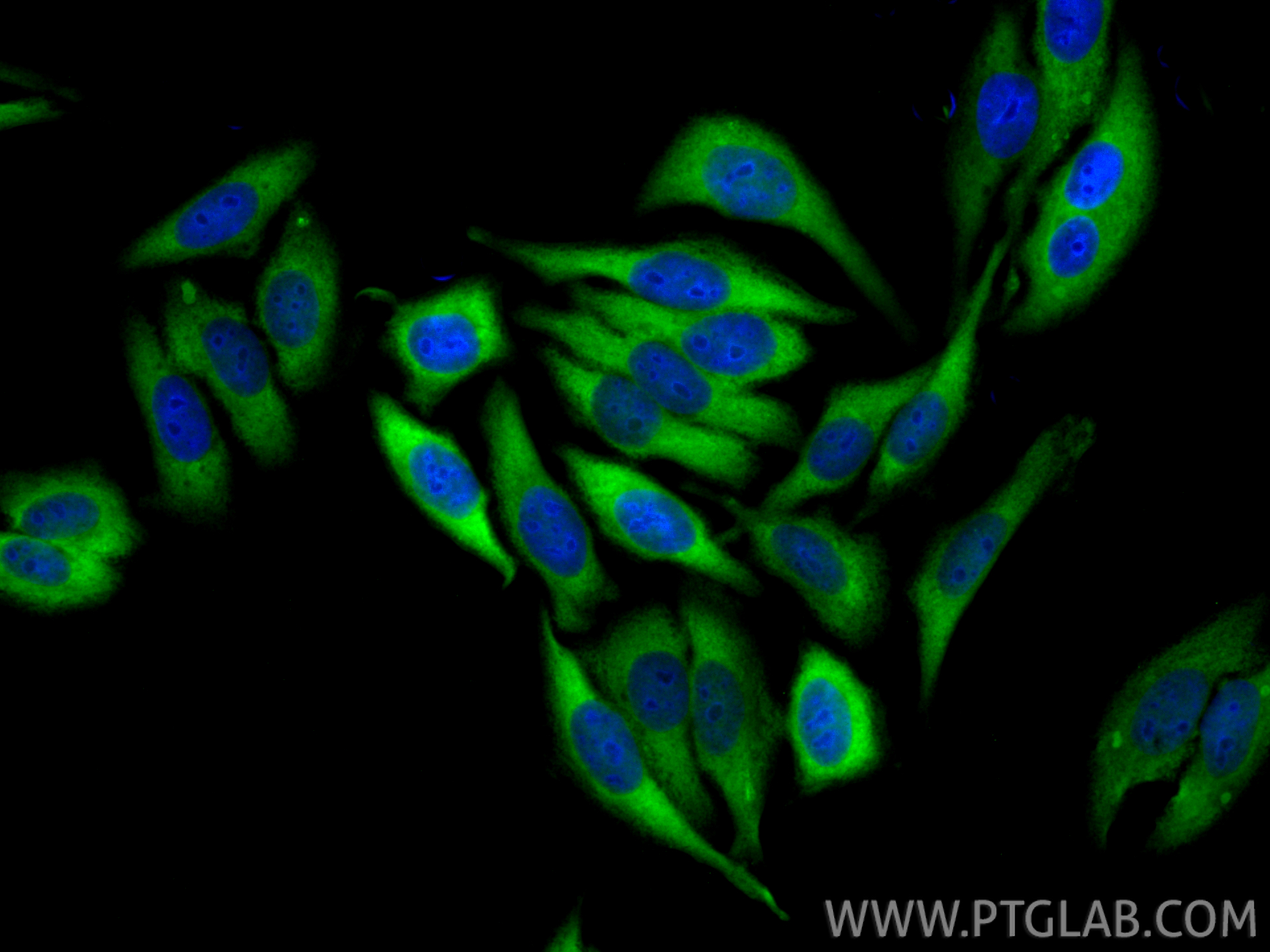 IF Staining of HepG2 using 10571-1-AP IF Staining of HepG2 using 10571-1-AP