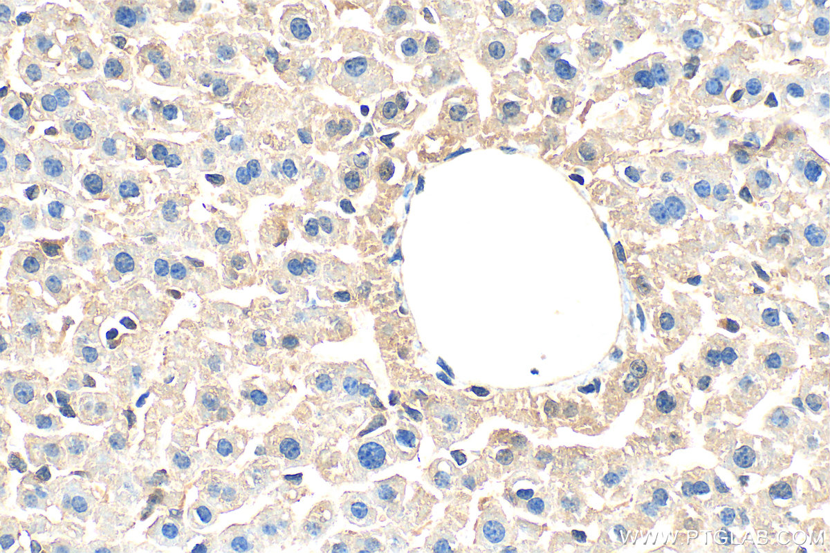 IHC staining of mouse liver using 10571-1-AP