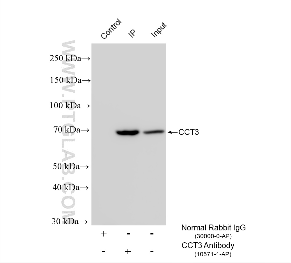 IP result of anti-CCT3 (IP:10571-1-AP, 4ug; Detection:10571-1-AP 1:15000) with mouse brain tissue lysate 1720 ug. IP experiment of mouse brain using 10571-1-AP