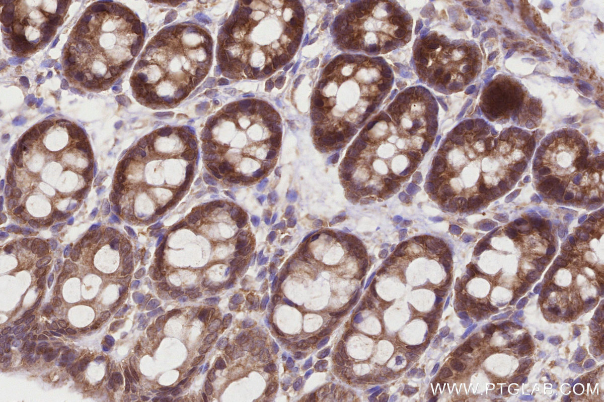 IHC staining of rat colon using 21524-1-AP IHC staining of rat colon using 21524-1-AP