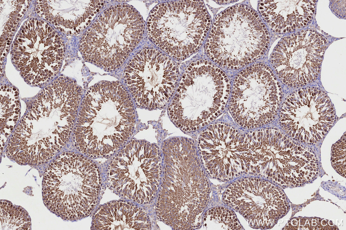 IHC staining of rat testis using 21524-1-AP IHC staining of rat testis using 21524-1-AP