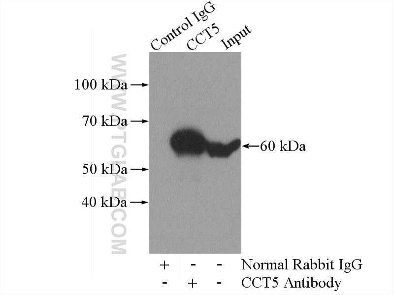 IP experiment of HeLa using 11603-1-AP