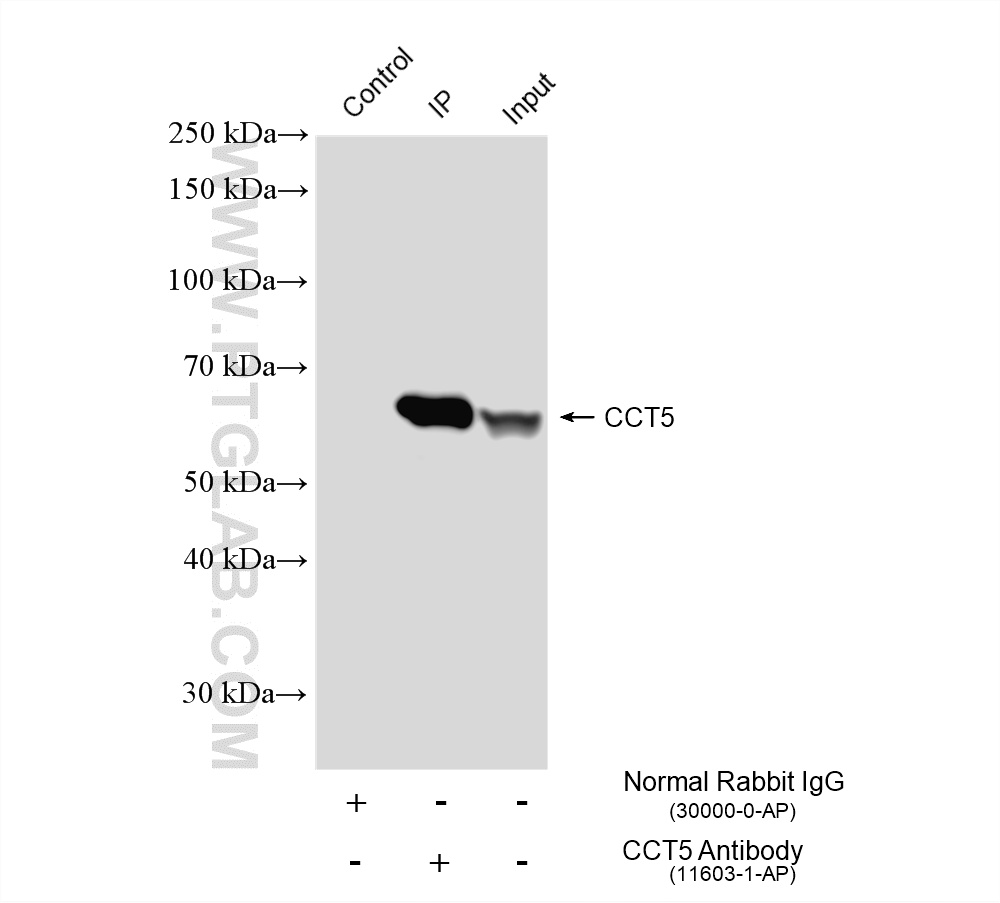 IP experiment of HeLa using 11603-1-AP