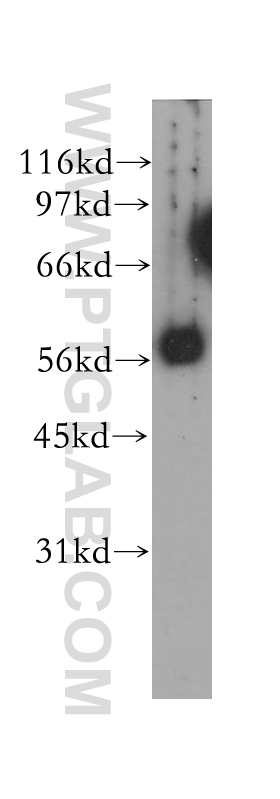 WB analysis of mouse ovary using 12628-1-AP