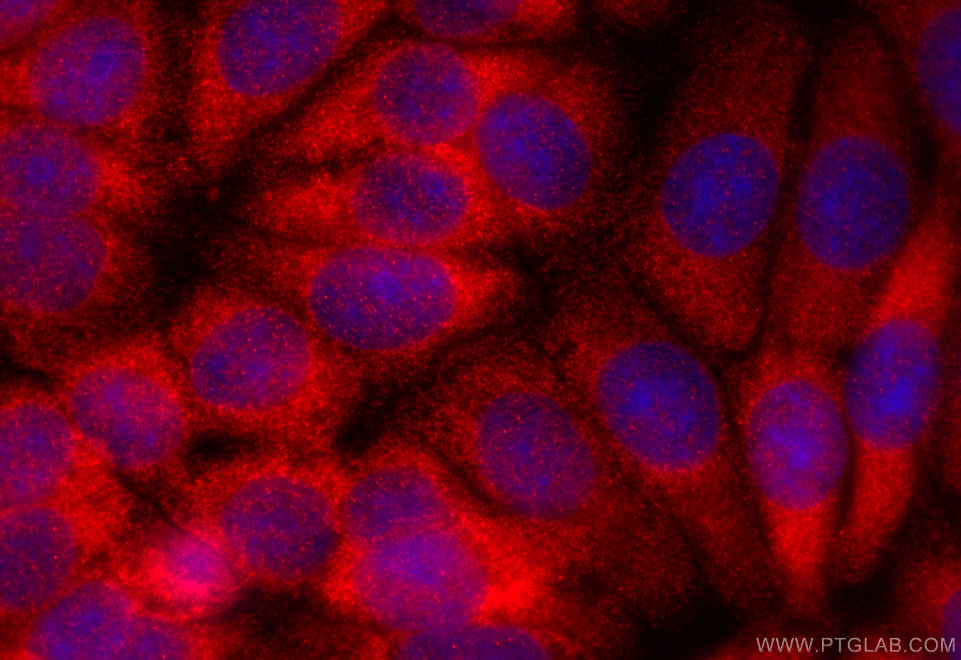 IF Staining of MCF-7 using 15994-1-AP