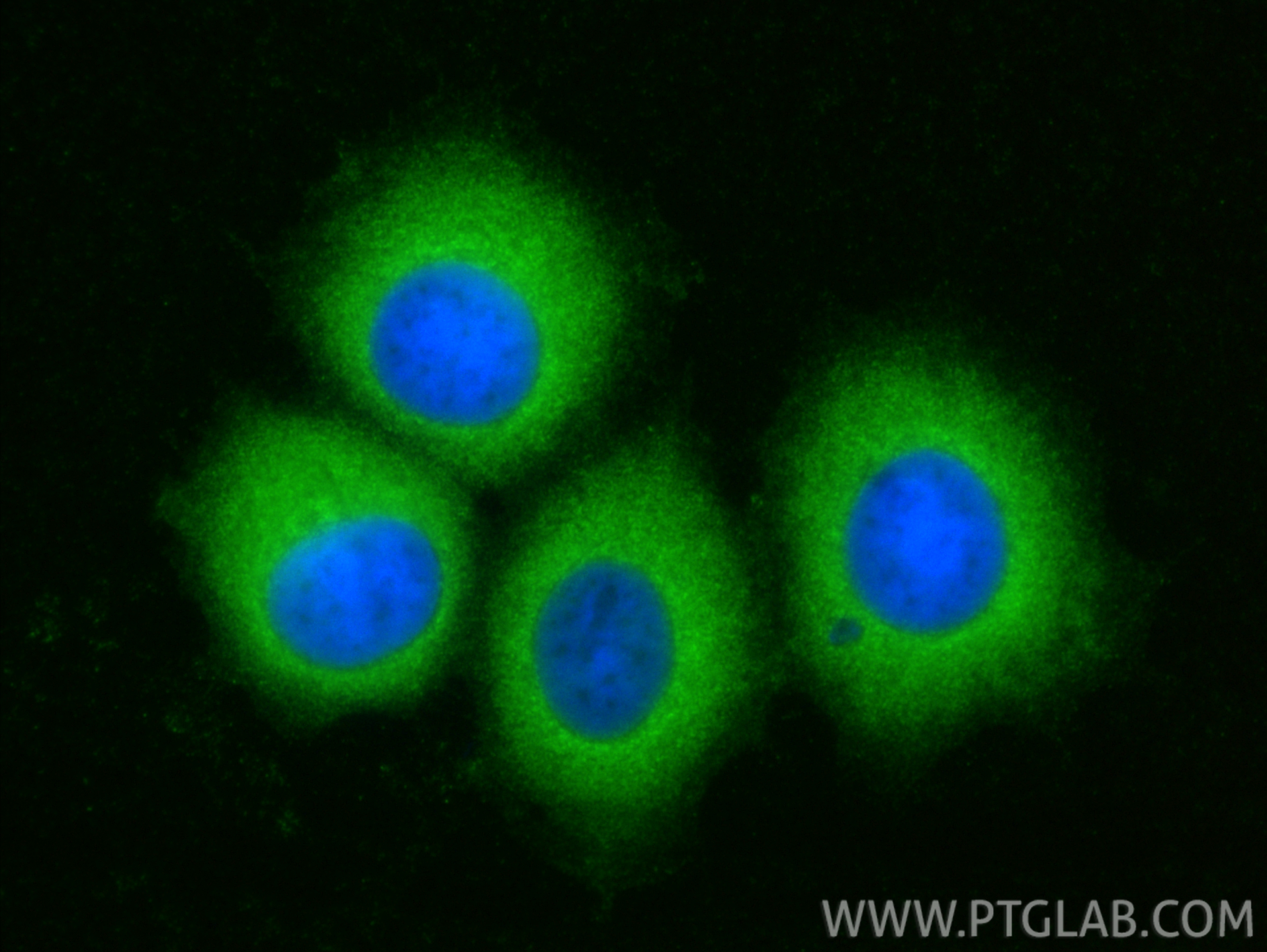 Immunofluorescent analysis of (-20°C Methanol) fixed MCF-7 cells using TCP1 eta antibody (15994-1-AP) at dilution of 1:800 and CoraLite®488-Conjugated Goat Anti-Rabbit IgG(H+L) (<a class='green' href='/productredirect?CatalogNo=SA00013-2' target='_blank'>SA00013-2</a>). IF Staining of MCF-7 using 15994-1-AP