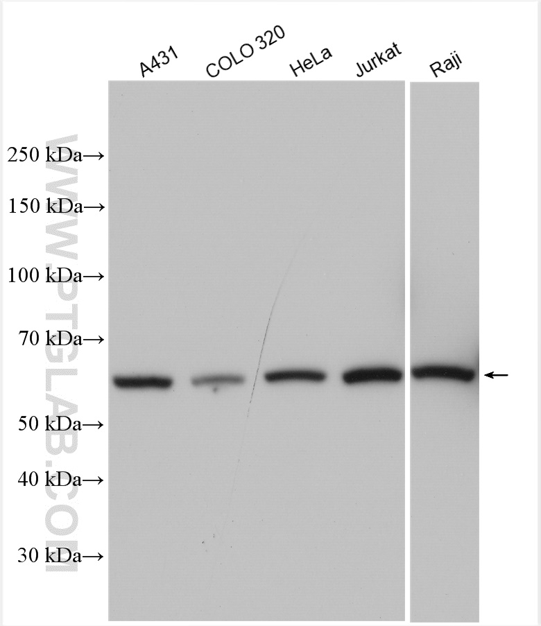 WB analysis using 12263-1-AP