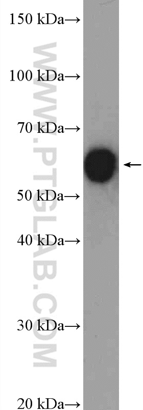 WB analysis of mouse kidney using 12263-1-AP