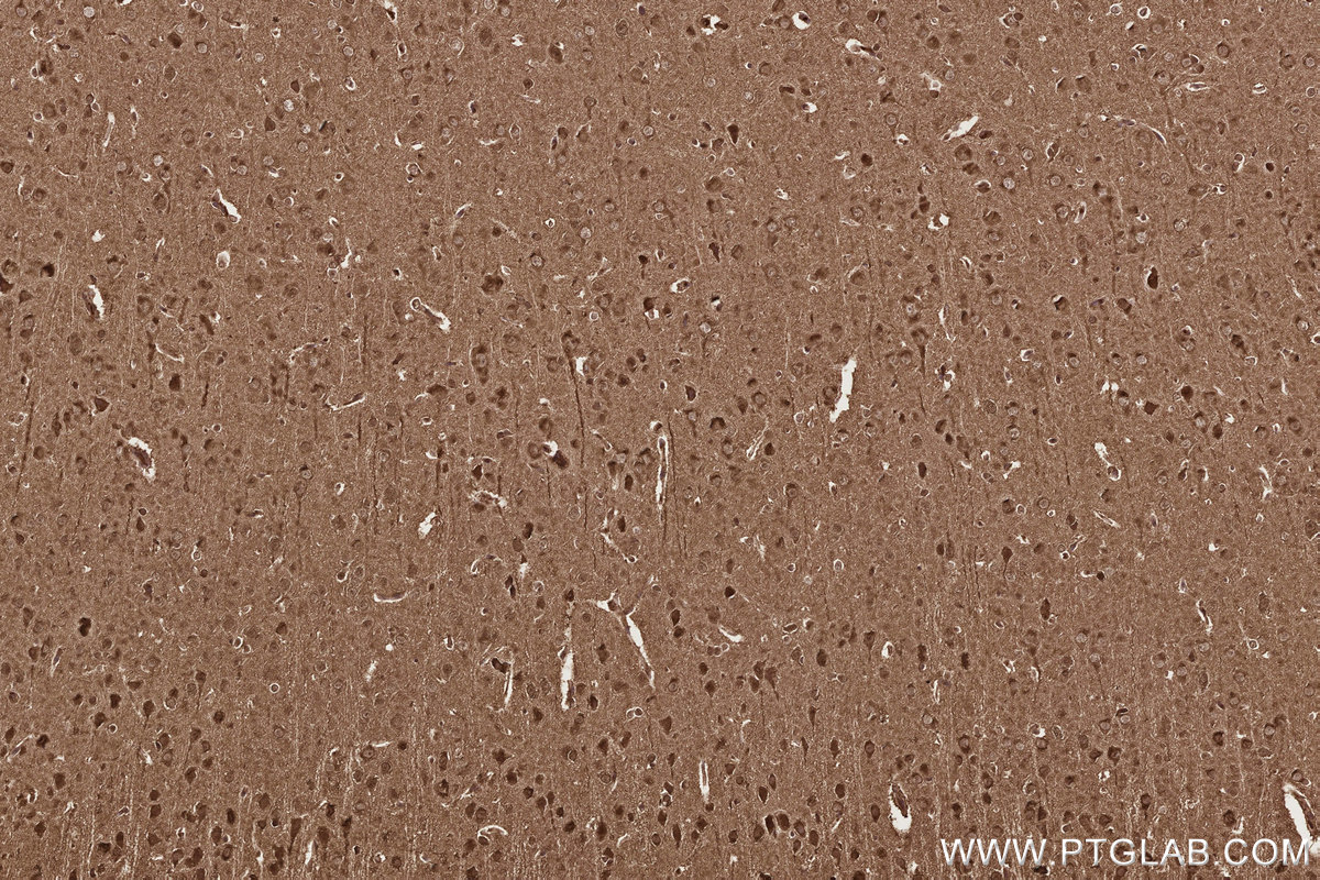 IHC staining of rat brain using 67539-1-Ig IHC staining of rat brain using 67539-1-Ig