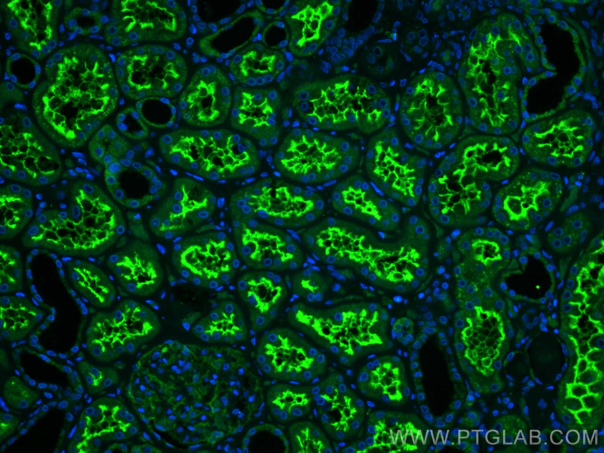 IF Staining of human kidney using 23782-1-AP