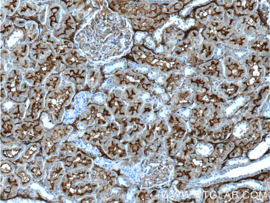 IHC staining of human kidney using 23782-1-AP