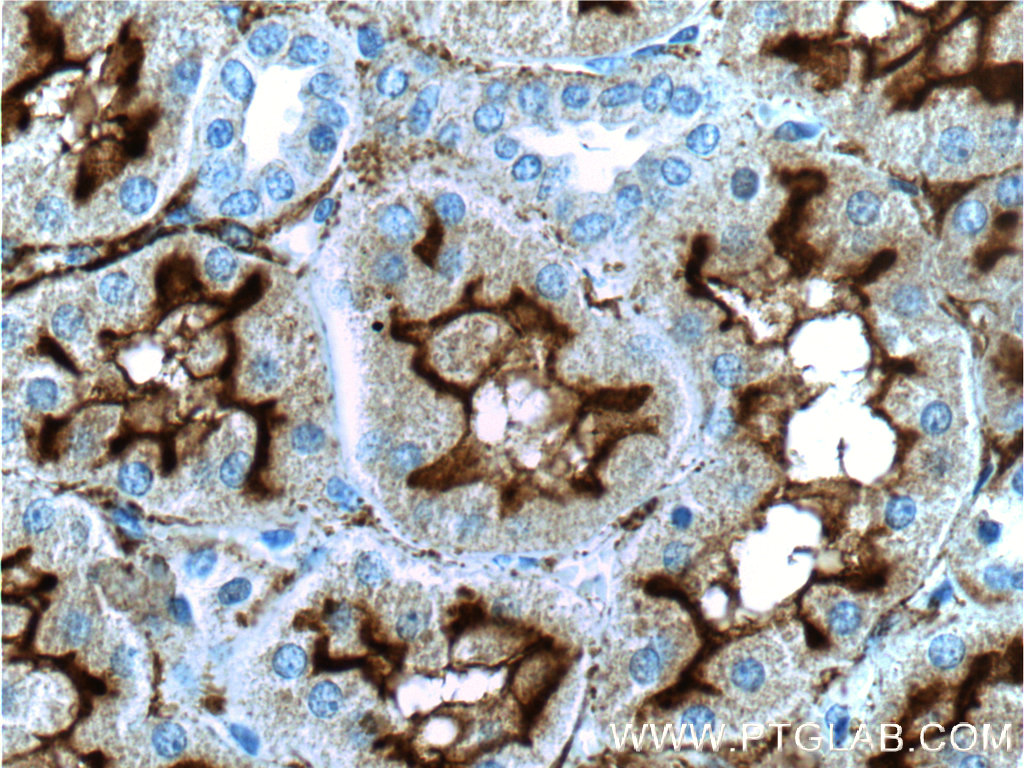 MME,CD10 Polyclonal antibody