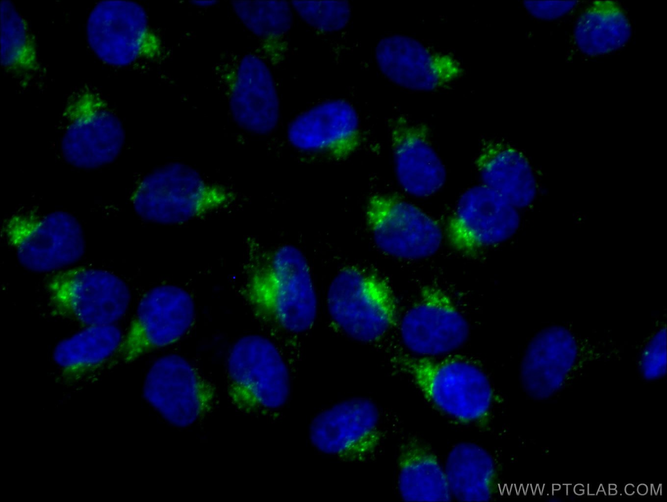 IF Staining of HeLa using 65051-1-Ig