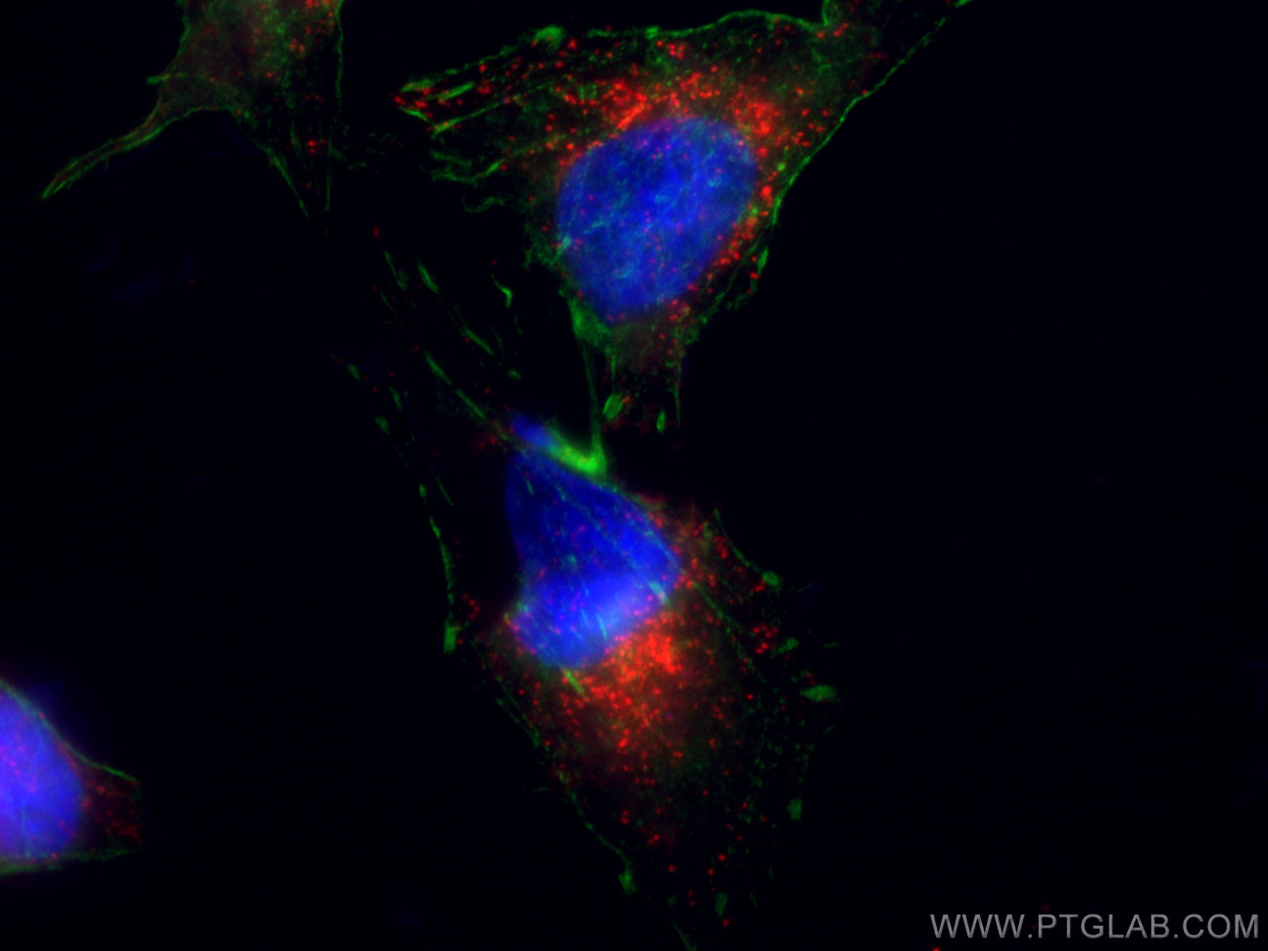 IF Staining of HeLa using CL594-65051