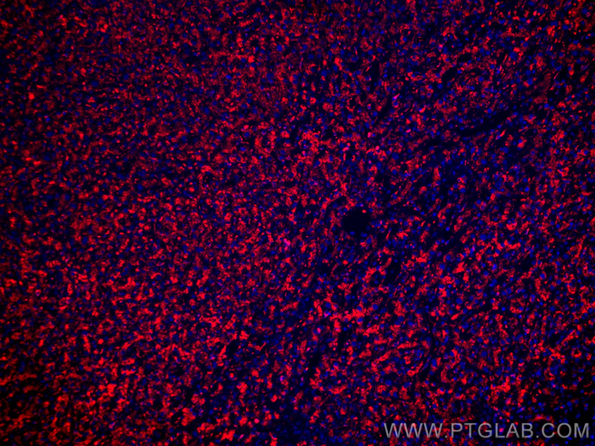 IF Staining of human liver cancer using CL594-67300