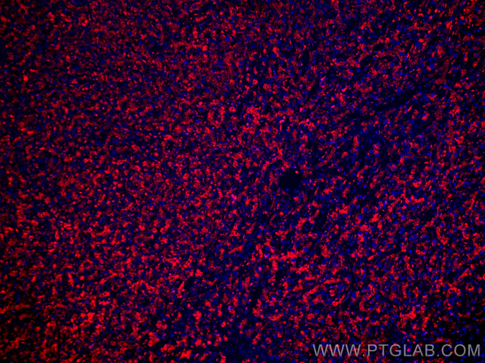 IF Staining of human liver cancer using CL594-67300