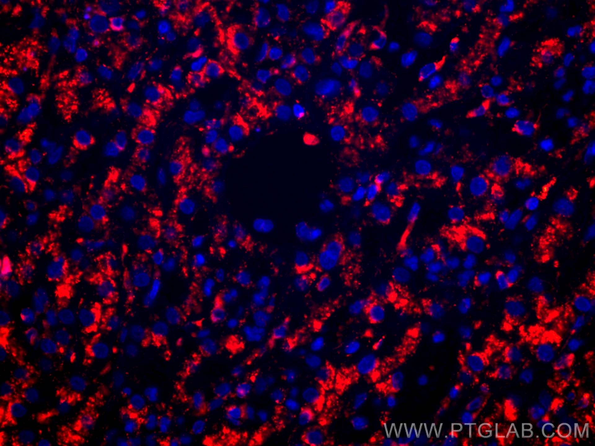 IF Staining of human liver cancer using CL594-67300