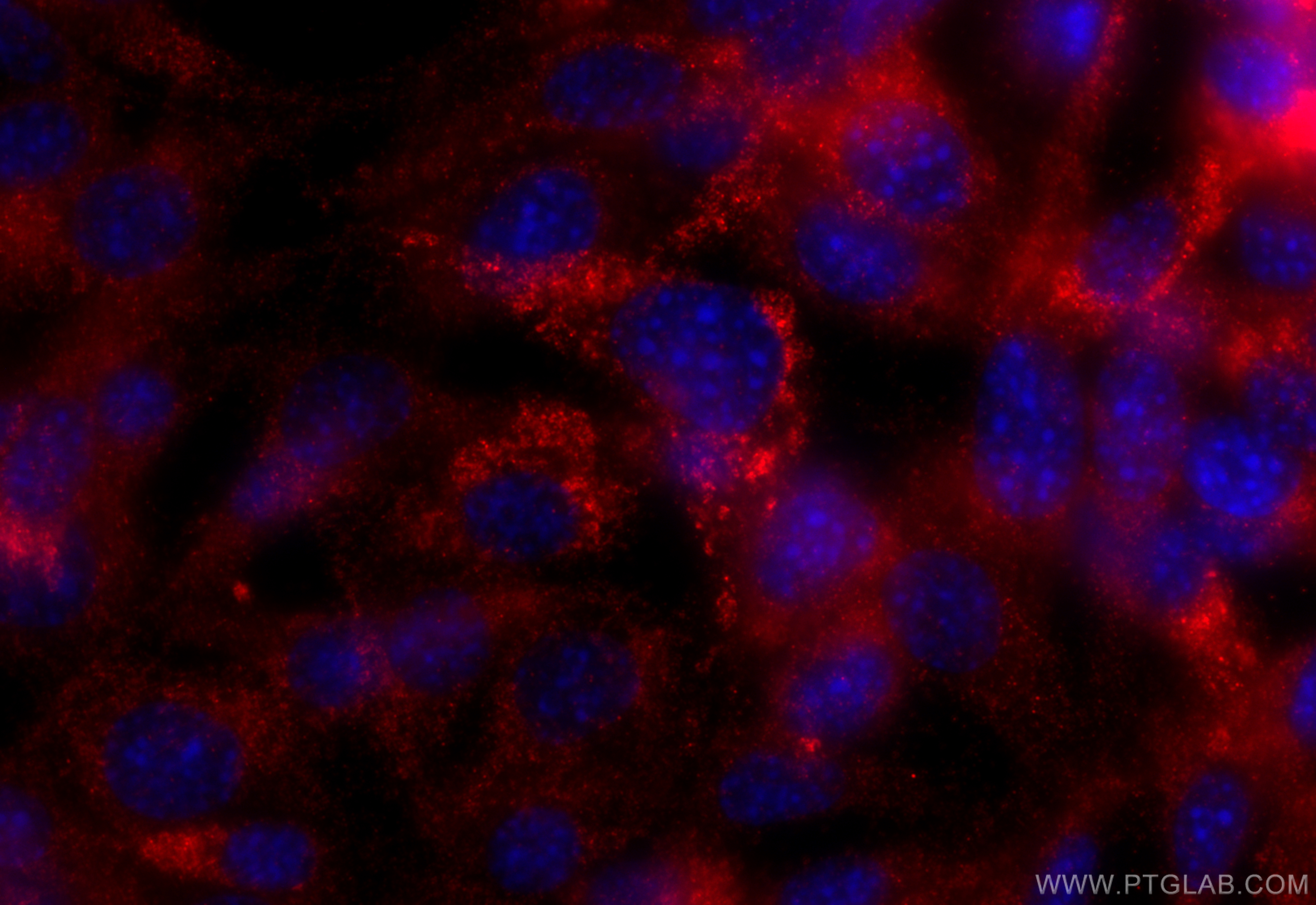 IF Staining of NIH/3T3 using 32435-1-AP