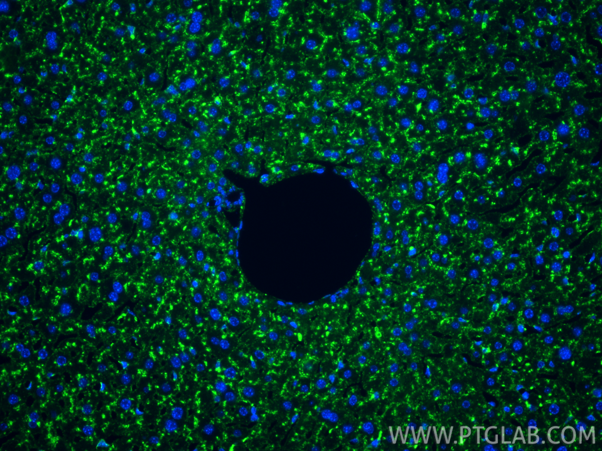 IF Staining of mouse liver using 86337-2-RR