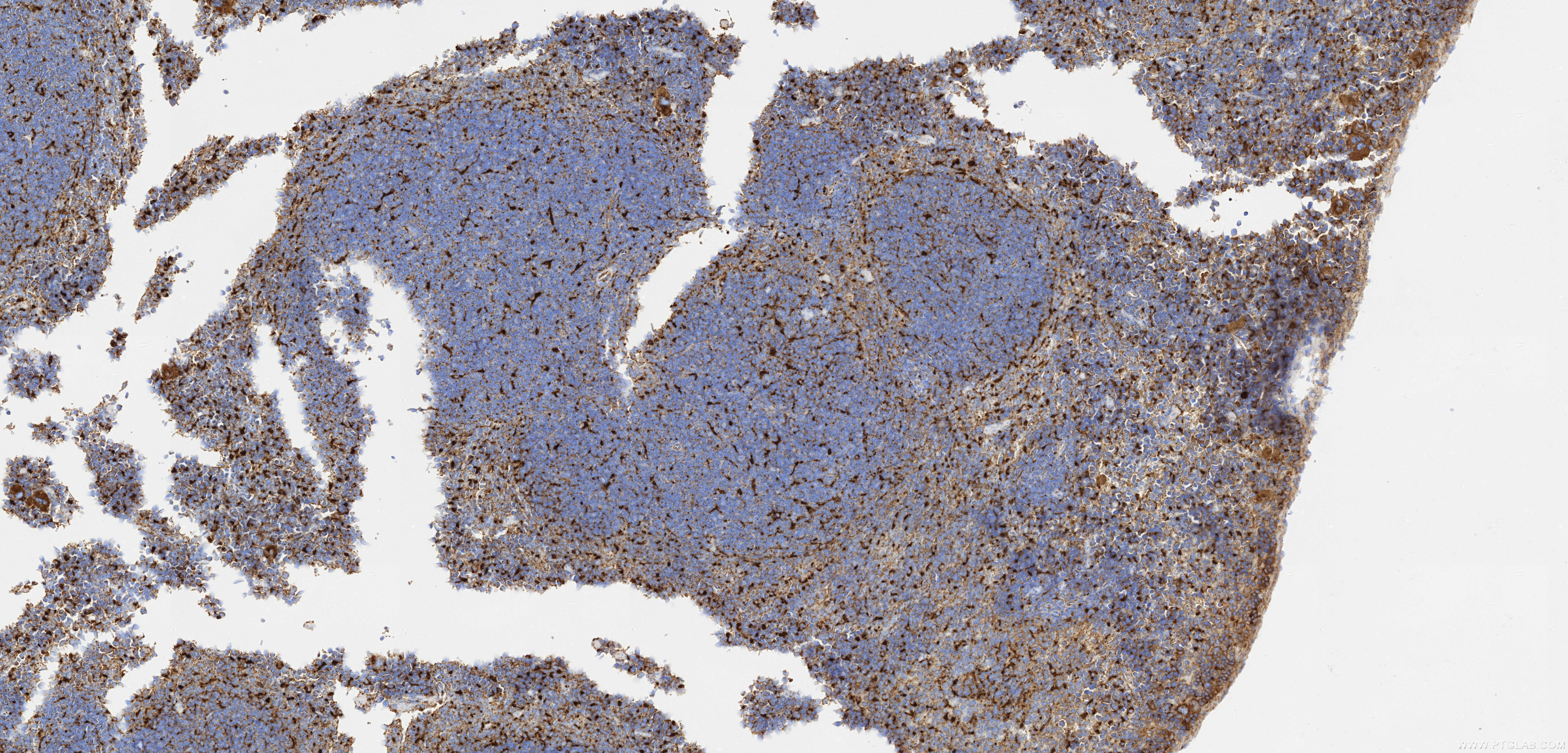 IHC staining of mouse spleen using 86337-2-RR (same clone as 86337-2-PBS)