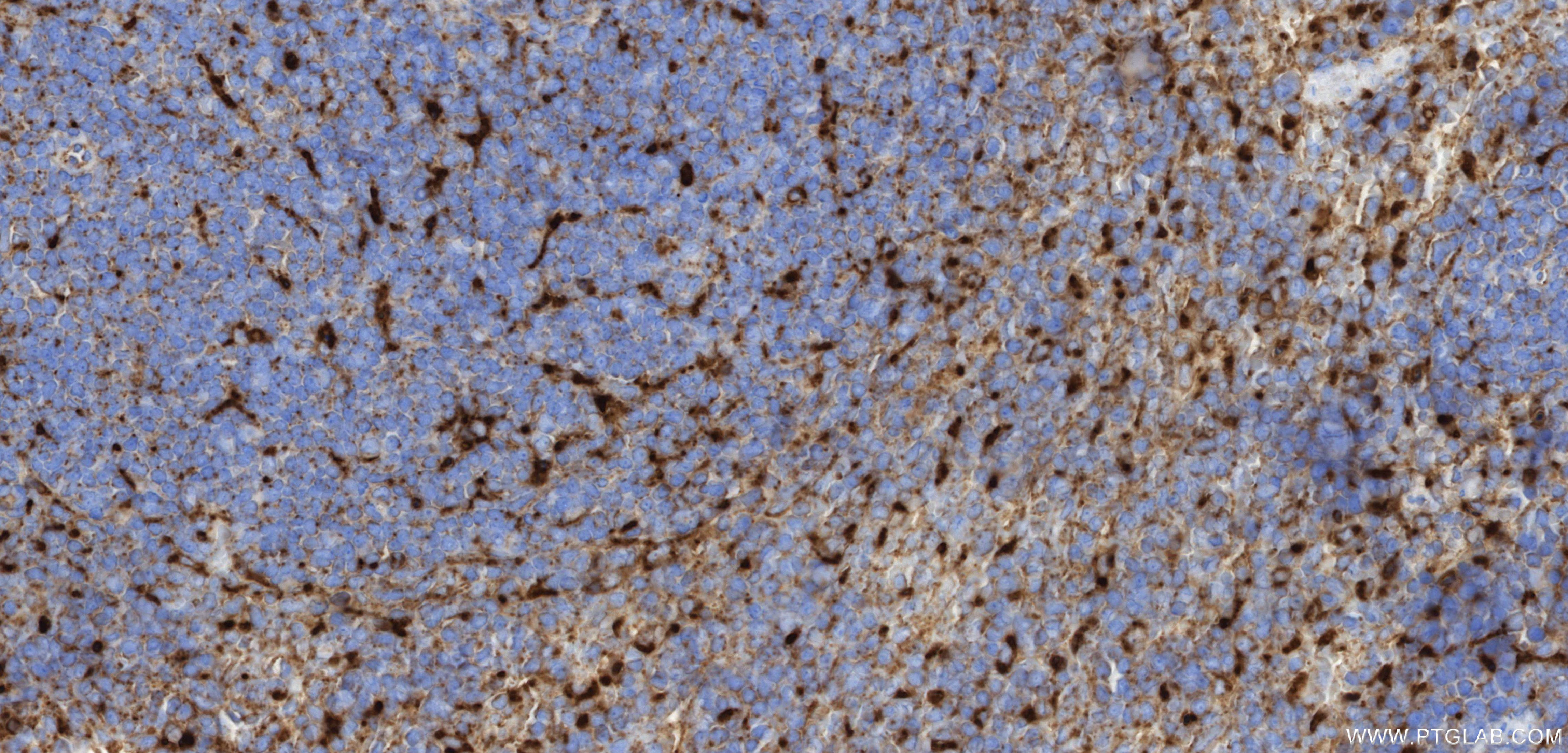 IHC staining of mouse spleen using 86337-2-RR (same clone as 86337-2-PBS)