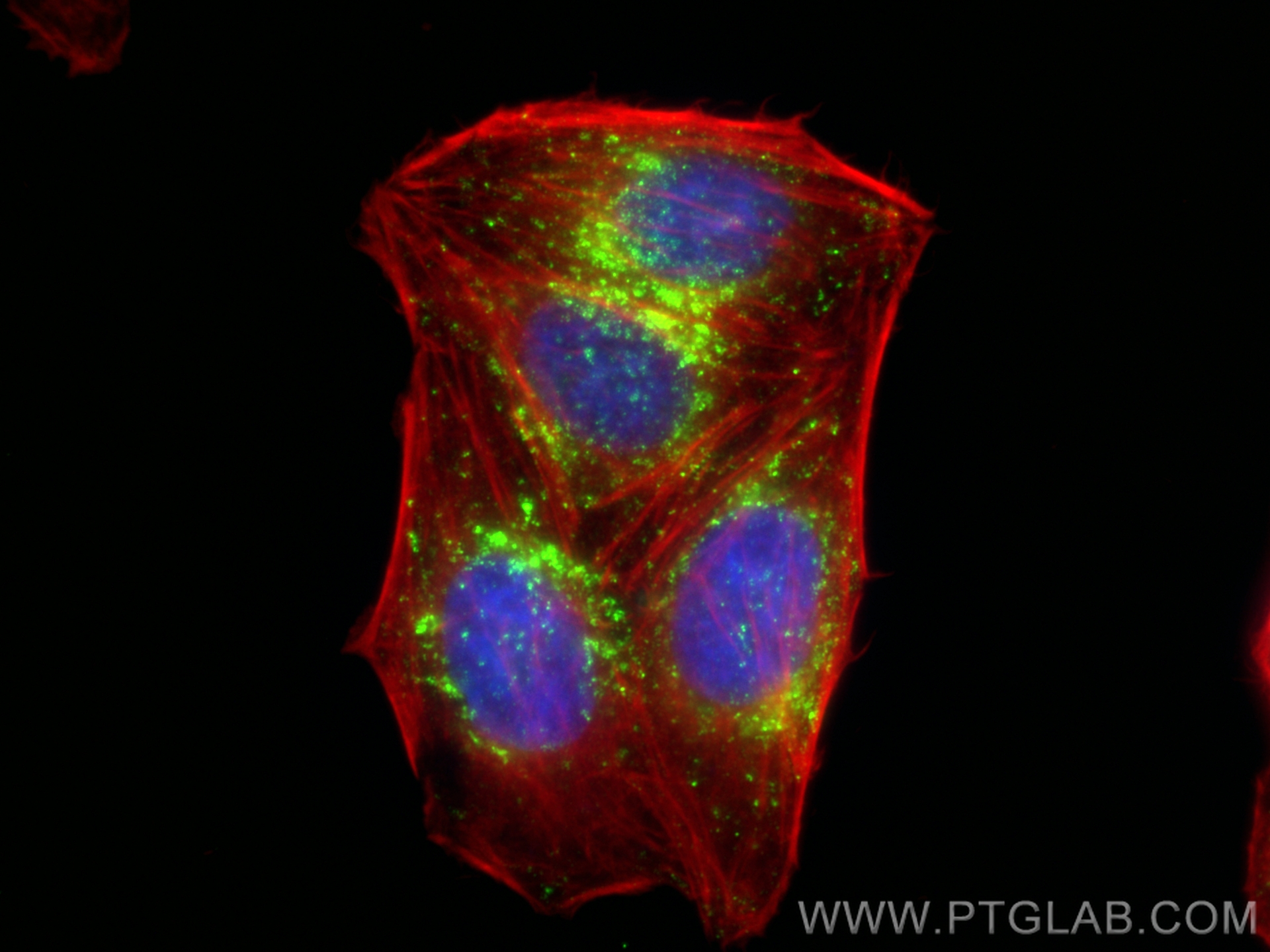 IF Staining of HepG2 using 98266-2-RR (same clone as 98266-2-PBS)
