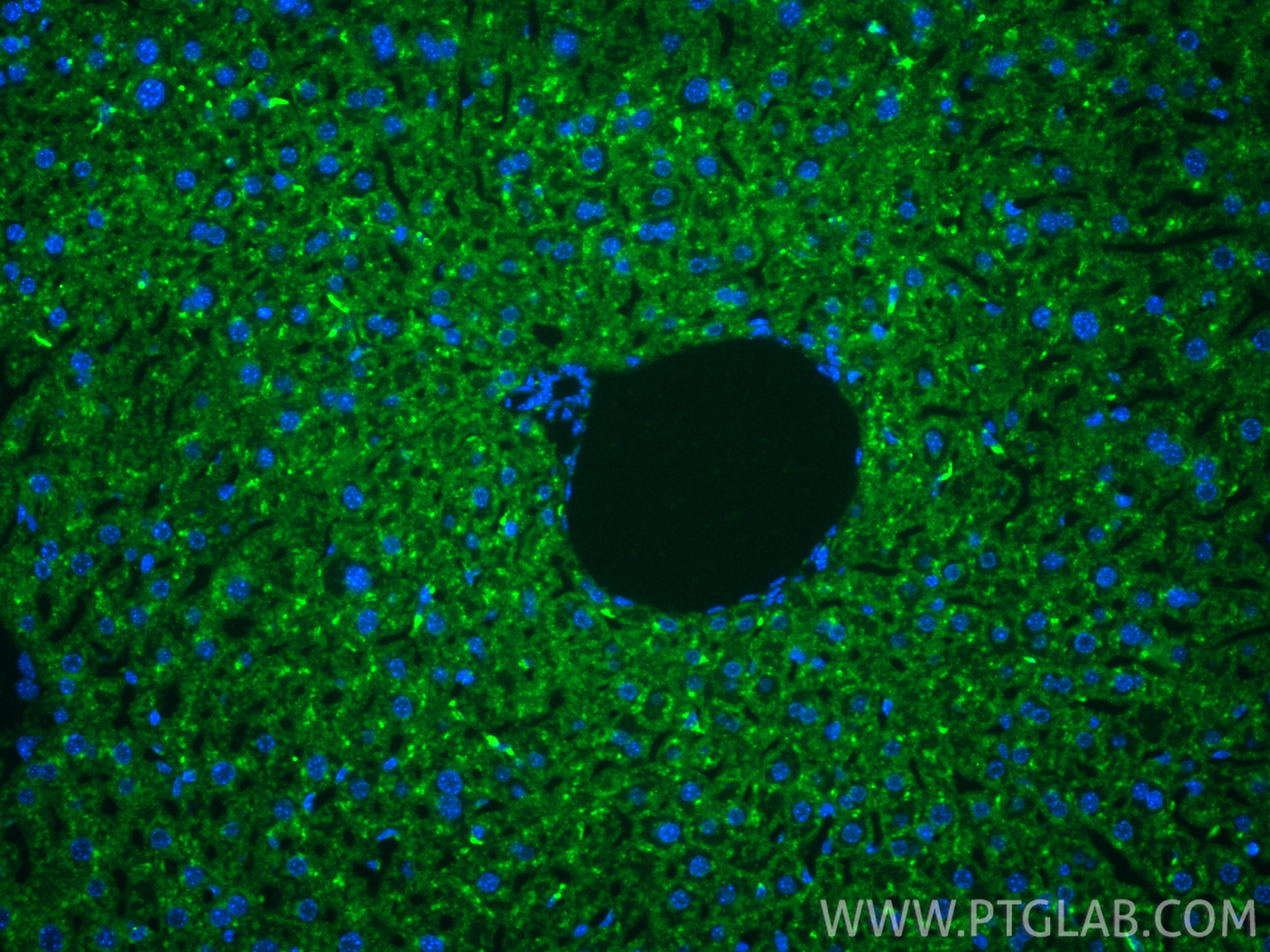IF Staining of mouse liver using 98537-2-RR