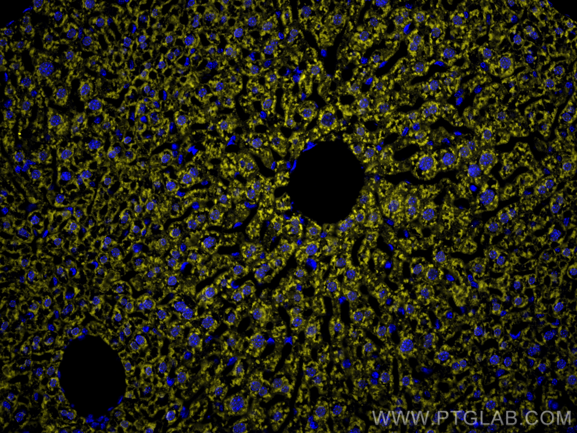 CD107a / LAMP1