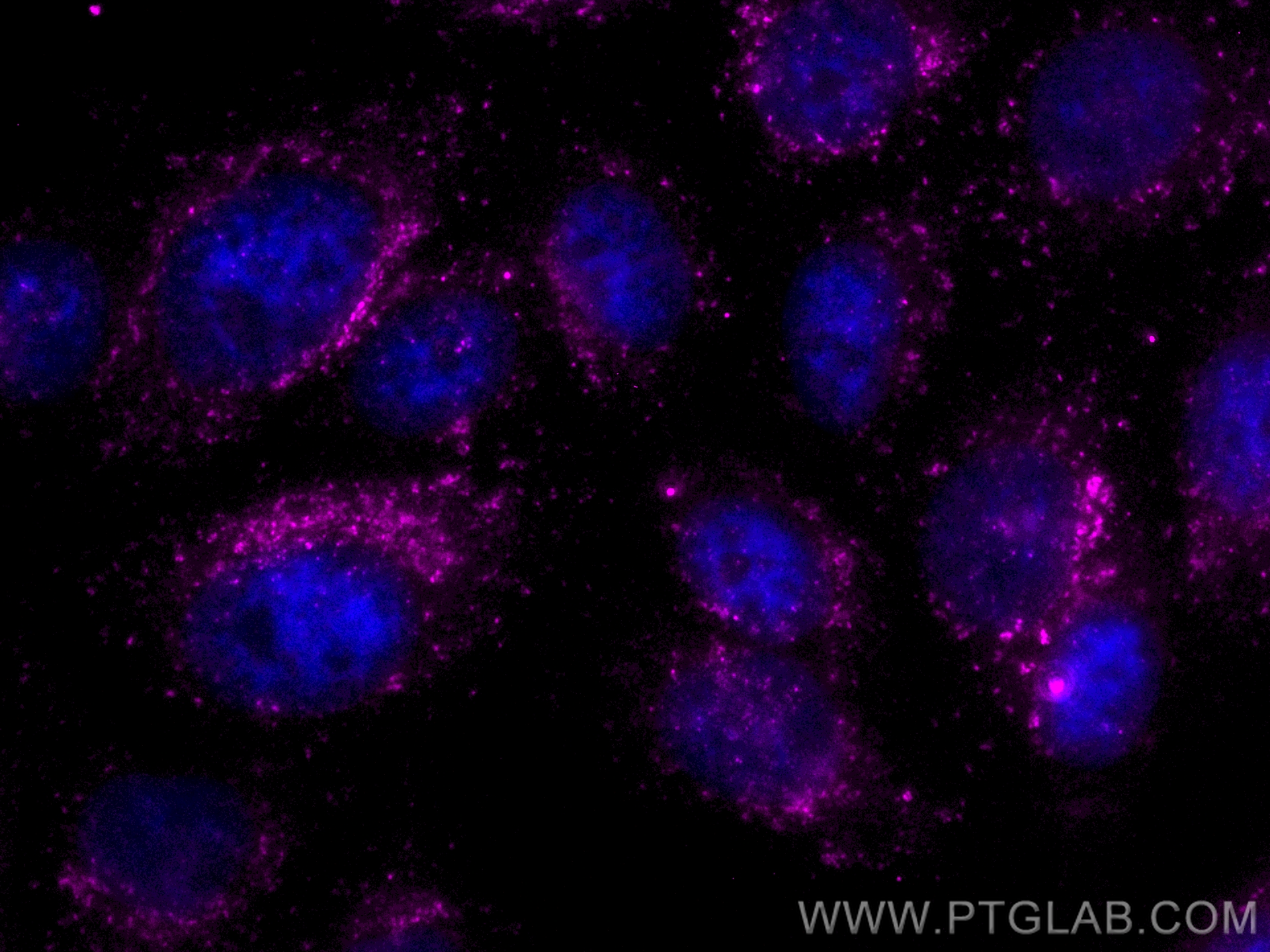 IF Staining of HepG2 using CL647-84658-5