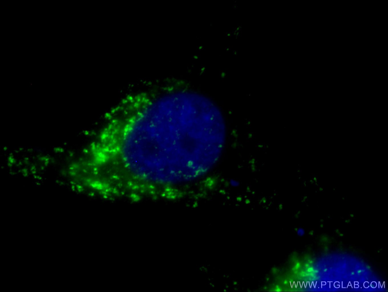 IF Staining of HeLa using 65053-1-Ig