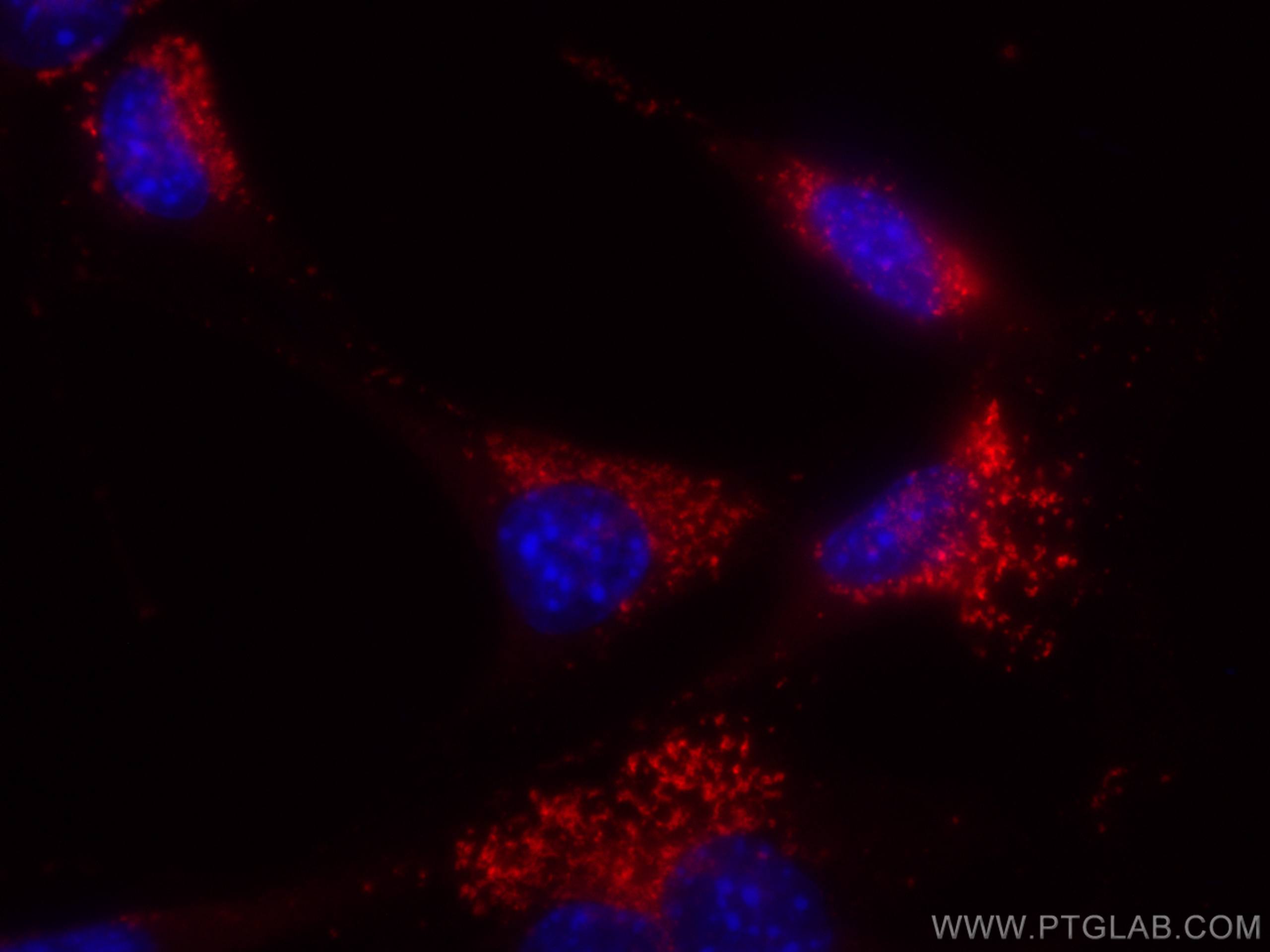 IF Staining of NIH/3T3 using CL555-65052