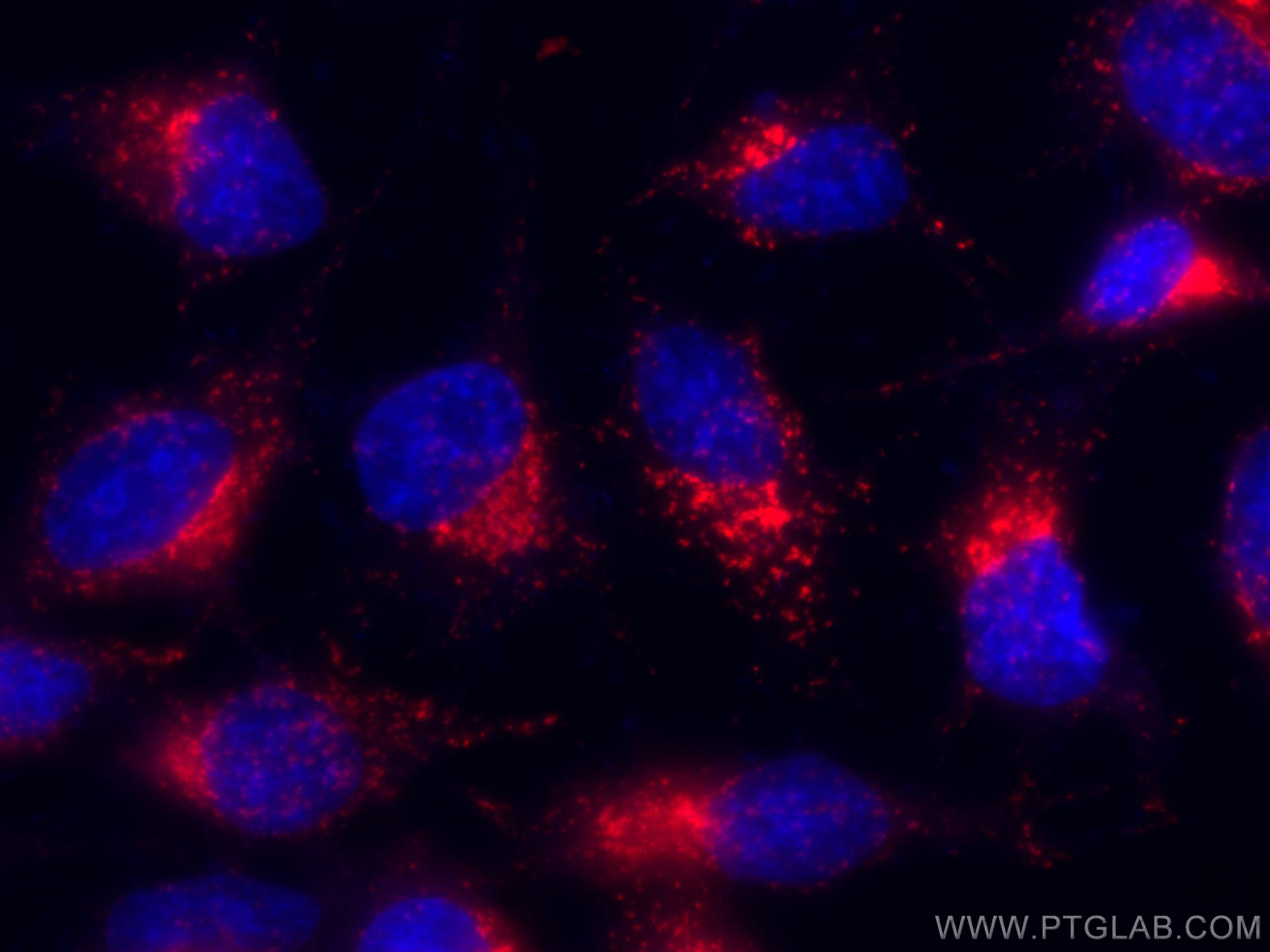 IF Staining of HeLa using CL594-65053