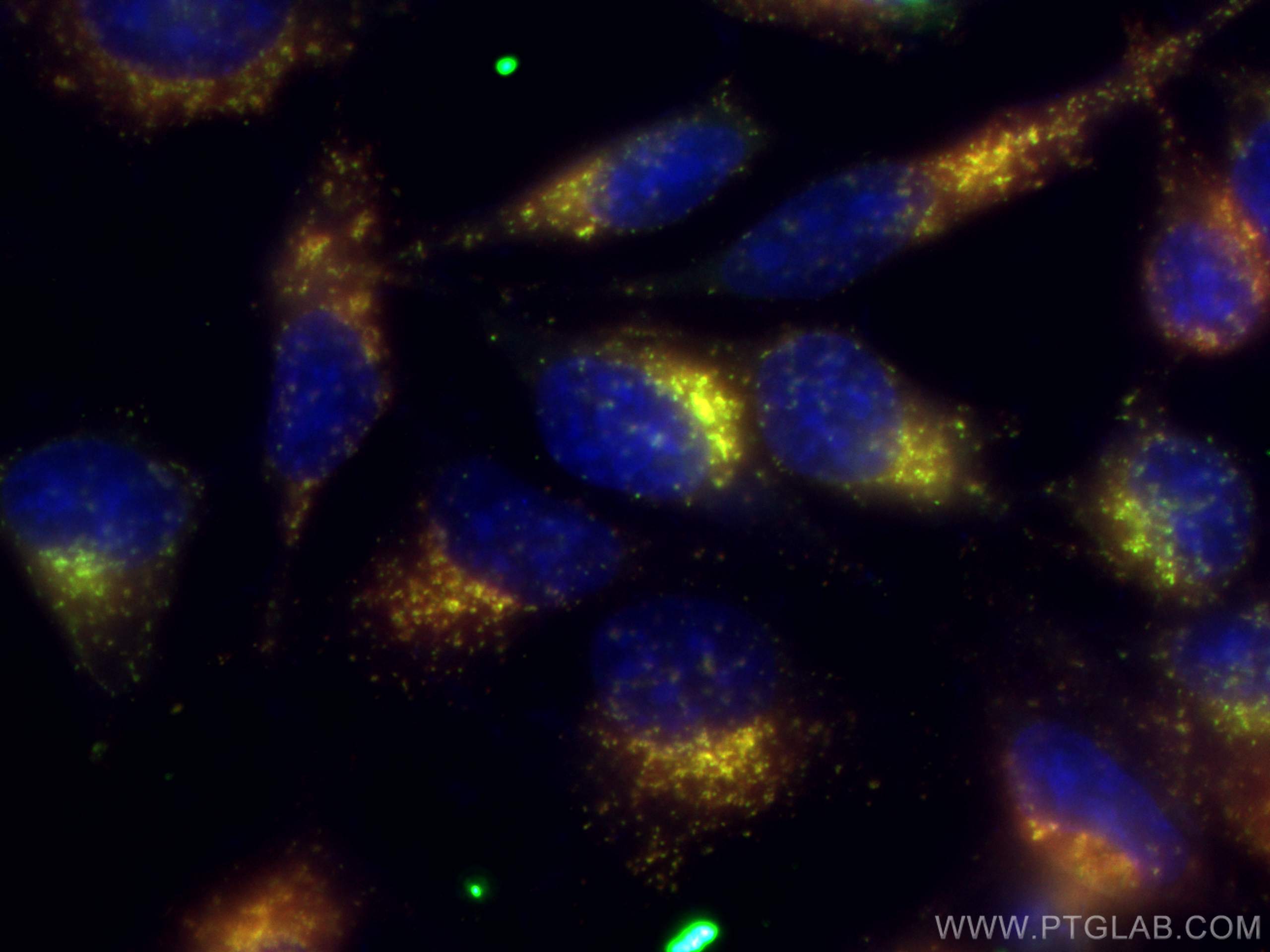 IF Staining of HeLa using CL647-65053